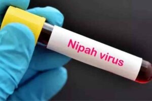 nipah virus