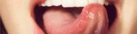 healthy tongue