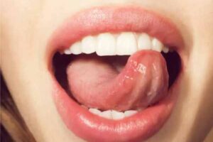 healthy tongue