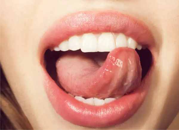 healthy tongue
