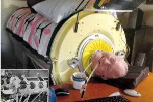 polio paul alexander story