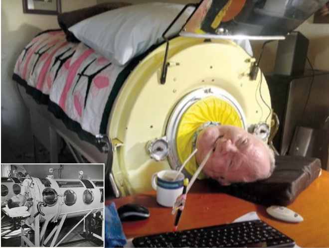 polio paul alexander story