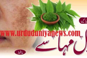 home remedies for pimples acne