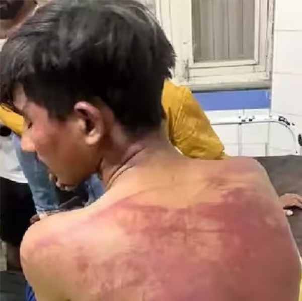 allegation of beating dalit employee by shoving a slipper in his mouth for asking for salary fir registered