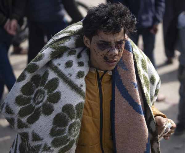 despite the decision of the international court of justice israeli brutality continues on gaza 183 more martyrs