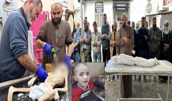 palestinian child yazan al kafarna died of malnutrition at abu yusuf al najjar hospital in rafah