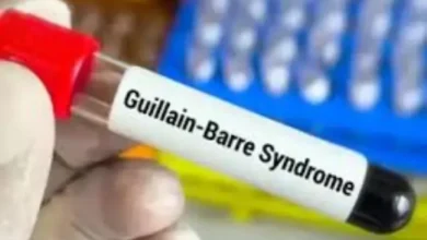 guillain barré syndrome