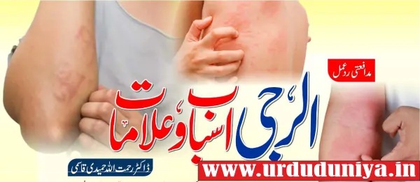 #ImmuneResponse, #AllergySymptoms, #CausesOfAllergy, #AllergicReaction, #ImmuneSystem, #AllergyTriggers, #AllergyRelief, #HealthTips, #ImmuneHealth, #AllergyAwareness