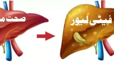 Fatty Liver vs Healthy Liver Comparison