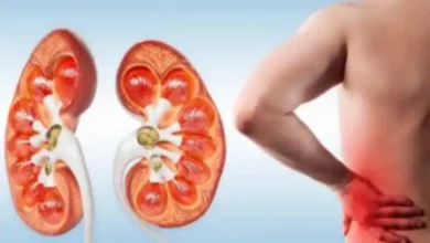 kidney stone warning signs