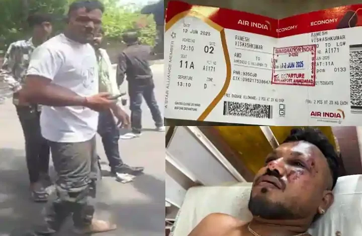 air india crash survivor vishwash
