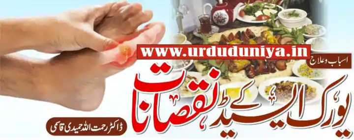 uric acid symptoms treatment