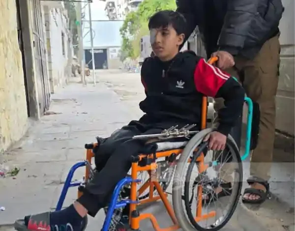 gaza injured child muhammad abu mohsen