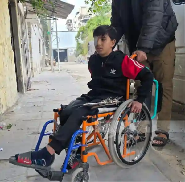 gaza injured child muhammad abu mohsen