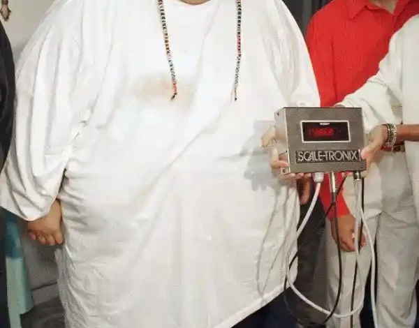 walter hudson obesity story