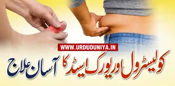 cholesterol uric acid treatment