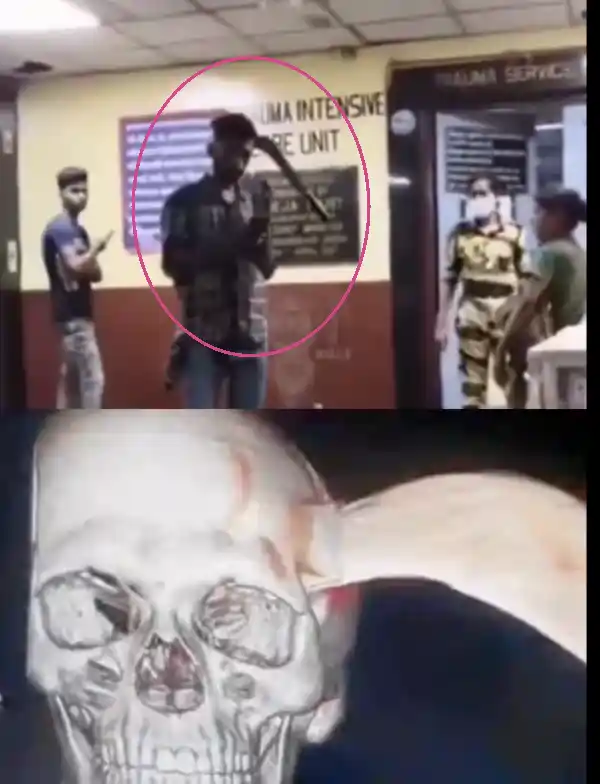 mumbai youth head attack