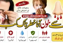 nose bleeding health tips
