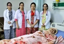 up quadruplets medical case 2026
