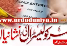 high cholesterol warning signs health.