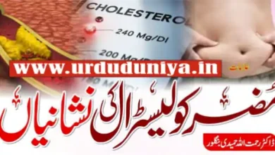 high cholesterol warning signs health.